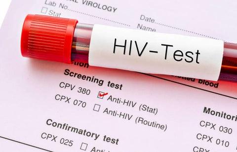Gambar Deteksi HIV Sedini Mungkin dengan Onestep HIV Tes
