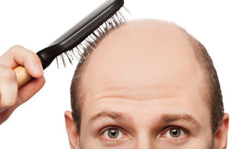 Gambar Tips Mengatasi Rambut Rontok dan Kebotakan Secara Alami