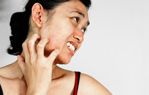 Gambar Waspada, Ini 5 Tanda Anda Memakai Moisturizer yang Salah