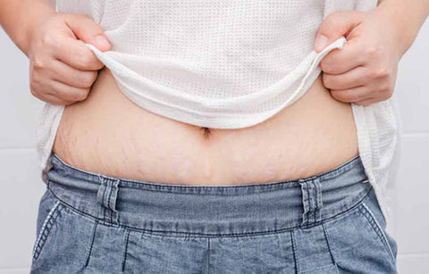 Gambar Banyak Stretch Mark Setelah Lahiran? Yuk Hilangkan Dengan 10 Cara Ini!