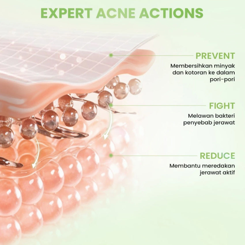 Hanasui Acne Expert Night Cream - 15 gr