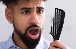 3 Gejala Awal Kebotakan pada Pria Ini Bisa Dicegah Lho!