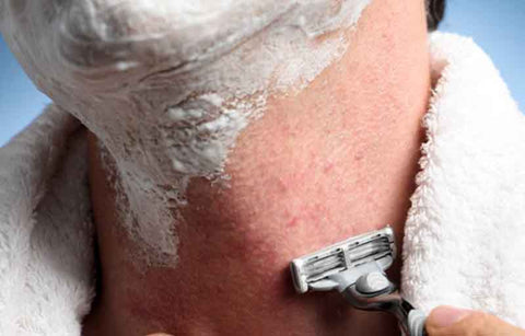 Gambar 6 Trik Hindari Razor Bumps Akibat Mencukur Jenggot