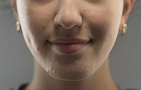 Gambar 7 Bahan Ini Haram Digunakan Kulit Mudah Berjerawat!