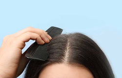 Adakah Perbedaan Antara Ketombe dan Kulit Kepala Kering?