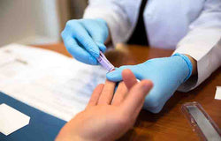 Apa Saja Cara-Cara Tes HIV?