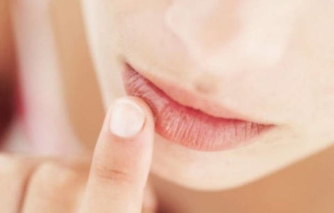 Gambar Atasi Bibir Pecah-Pecah dengan 5 Bahan Alami Ini