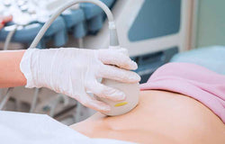 Bunda, Yuk Kenali Tanda, Sebab, dan Risiko Hamil Anggur!