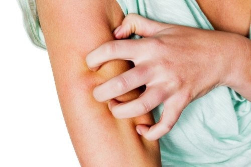 Cara Meredam Iritasi atau Alergi Pada Kulit Tubuh
