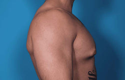 Gentlemen, Anda Patut Waspada Jika Dada Anda Terlalu Besar, Lho