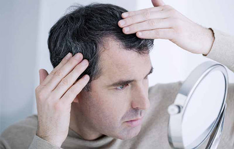 Gambar Guys, Ini Dia Tanda-tanda Rambut Rontok dan Penyebabnya