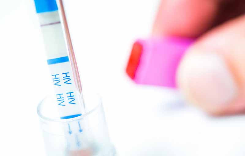 Haruskah Anda Tes HIV?