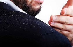 Hilangkan Ketombe dengan 8 Cara Alami