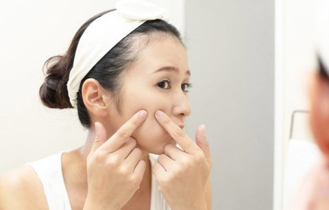 Gambar Kenali Lebih Dekat 6 Fakta Jerawat Hormon & Cara Mengatasinya!