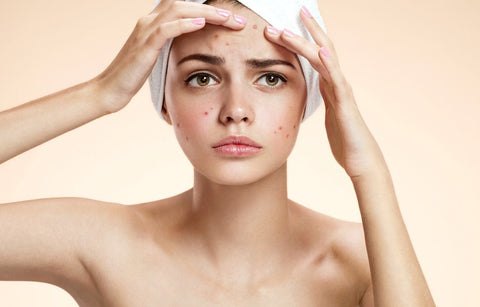 Gambar Ladies, 6 Bahan Alami Ini Ternyata Berbahaya Bagi Wajah