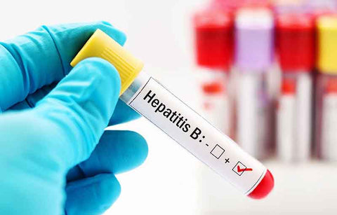 Gambar Masihkah Anda Percaya 5 Mitos tentang Penyakit Menular Seksual Ini?