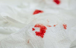 Pendarahan Setelah Seks Anal? Waduh, Apakah Normal?