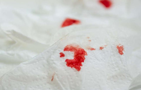 Gambar Pendarahan Setelah Seks Anal? Waduh, Apakah Normal?