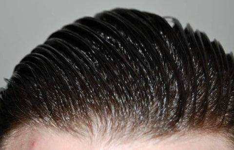 Gambar Rambut Sering Lepek? Atasi dengan 5 Cara Ini