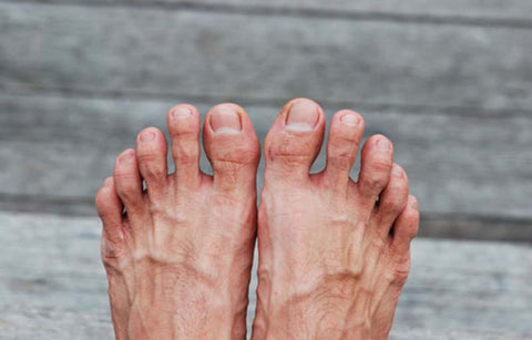 Gambar Kaki Bau karena Sering Pakai Sepatu? Ini 6 Cara Efektif Mengatasinya!