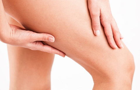 Gambar Bio Oil vs Palmer’s, Mana Krim Anti Stretch Mark Terbaik?