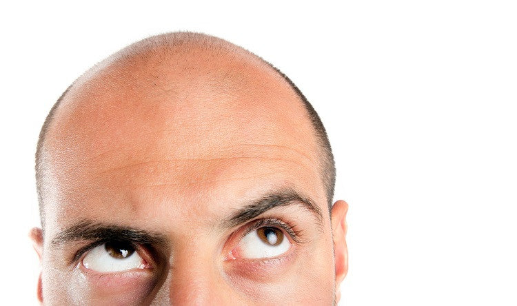 Cegah Kebotakan dengan Humphrey Hairloss Shampoo