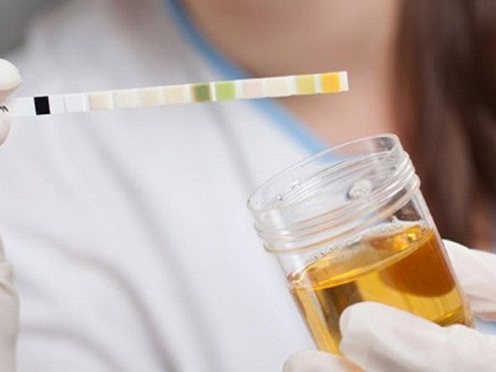 Deteksi Masalah Kesehatan Dari Warna Urine