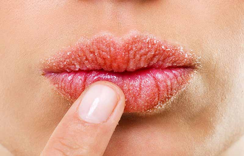 5 Cara Alami yang Efektif Mencegah Bibir Kering